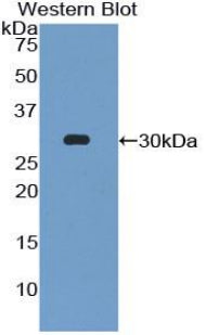 DAB staining on IHC-P; Samples: Mouse Cerebrum Tissue;  Primary Ab: 20µg/ml Rabbit Anti-Mouse EGR4 A