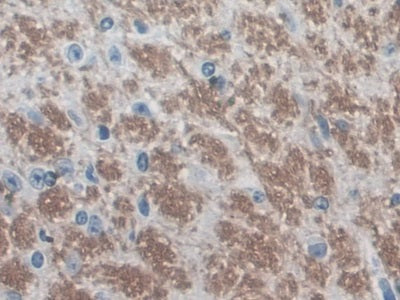 DAB staining on IHC-P; Samples: Mouse Cerebrum Tissue