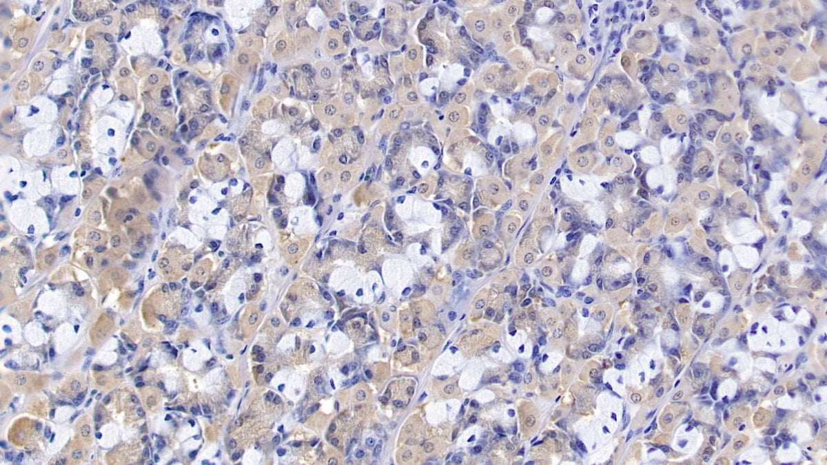 DAB staining on fromalin fixed paraffin-embedded Liver tissue)