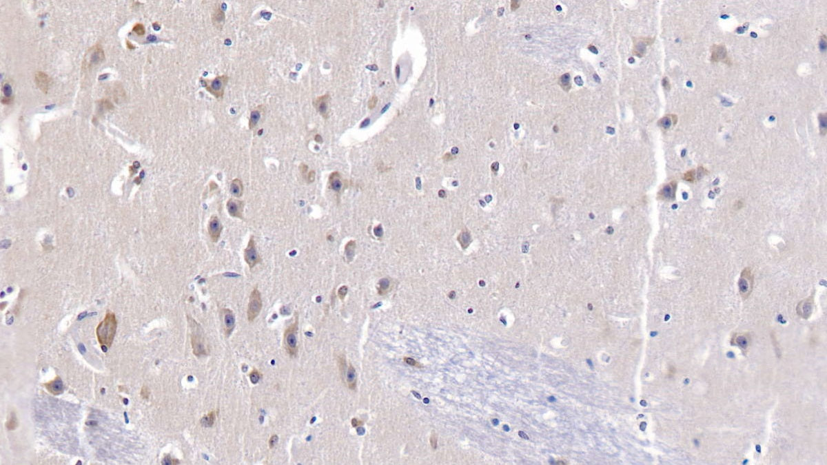 Heat Shock 70kDa Protein 9 (HSPA9) Polyclonal Antibody - image 4