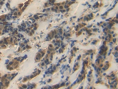 DAB staining on IHC-P; Samples: Human Kidney Tissue.