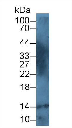 DAB staining on IHC-P; Samples: Bovine Small intestine Tissue; Primary Ab: 20μg/ml Rabbit Anti-Bovine S100A12 Antibody Second Ab: 2µg/mL HRP-Linked Caprine Anti-Rabbit IgG Polyclonal Antibody