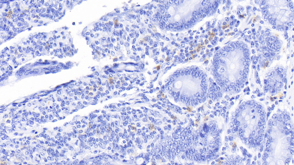 DAB staining on IHC-P; Samples: Bovine Liver Tissue; Primary Ab: 20μg/ml Rabbit Anti-Bovine S100A12 Antibody Second Ab: 2µg/mL HRP-Linked Caprine Anti-Rabbit IgG Polyclonal Antibody