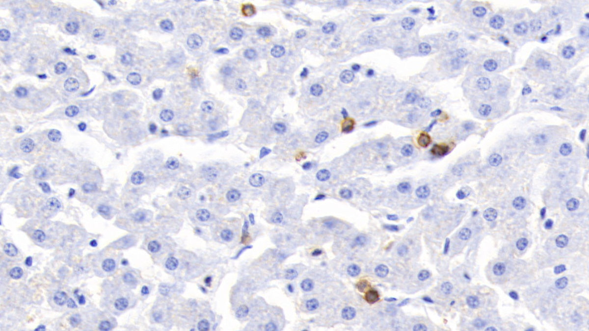 S100 Calcium Binding Protein A12 (S100A12) Polyclonal Antibody - image 5