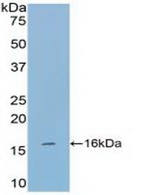 Tryptase (TPS) Polyclonal Antibody - image 3
