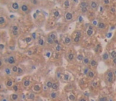 Tryptase (TPS) Polyclonal Antibody - image 4