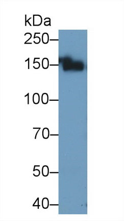 Western Blot; Sample: Recombinant protein.