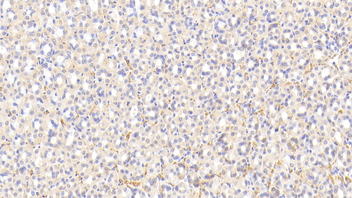 DAB staining on fromalin fixed paraffin-embedded Kidney tissue)