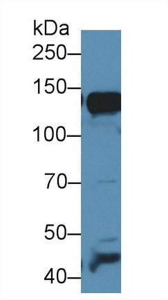Western Blot; Sample: Recombinant protein.