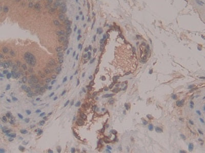 DAB staining on fromalin fixed paraffin-embedded Kidney tissue)