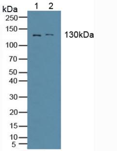 Western Blot; Sample: Recombinant AAP, Human.