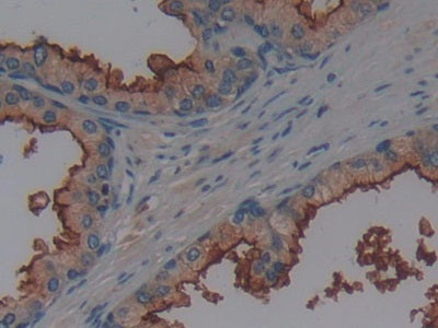 DAB staining on IHC-P; Samples: Human Kidney Tissue.