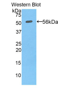 Western Blot; Sample: Lane1: Mouse Lung lysate; Lane2: Mouse Liver lysate; Lane3: Mouse Kidney lysate; Lane4: Mouse Cerebrum lysate<br/>Primary Ab: 2µg/mL Rabbit Anti-Mouse PDI Antibody<br/>Second Ab: 0.2µg/mL HRP-Linked Caprine Anti-Rabbit IgG Polyclonal Antibody<br/>