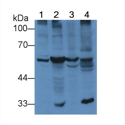 FITC staining on IF; Samples: Human MCF7 cell;  Primary Ab: 20μg/ml Rabbit Anti-Mouse PDI Antibody Second Ab: 1.5μg/ml FITC-Linked Caprine Anti-Rabbit IgG Polyclonal Antibody