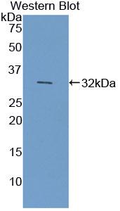 Cytochrome P450 7A1 (CYP7A1) Polyclonal Antibody - image 2
