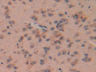 Cytochrome P450 7A1 (CYP7A1) Polyclonal Antibody - image 3