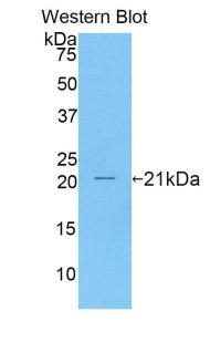 Western Blot; Sample: Raji cell lysate; Primary Ab: 1μg/ml Rabbit Anti-Human TNFRSF7 Antibody; Second Ab: 0.2µg/mL HRP-Linked Caprine Anti-Rabbit IgG Polyclonal Antibody;