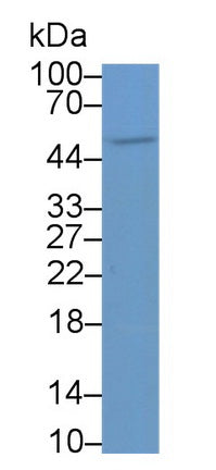 DAB staining on IHC-P; Samples: Human Spleen Tissue;  Primary Ab: 20μg/ml Rabbit Anti-Human TNFRSF7 Antibody Second Ab: 2µg/mL HRP-Linked Caprine Anti-Rabbit IgG Polyclonal Antibody