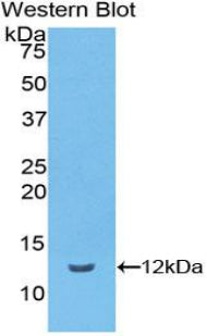 Vitronectin (VTN) Polyclonal Antibody - image 3
