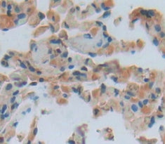 Vitronectin (VTN) Polyclonal Antibody - image 4