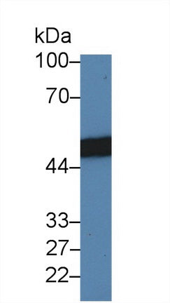 Western Blot; Sample: Recombinant protein.