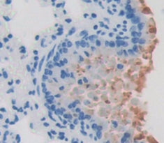 Surfactant Associated Protein D (SPD) Polyclonal Antibody - image 4