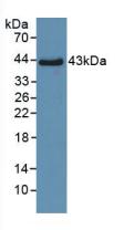 DAB staining on IHC-P; Samples: Human Lung Tissue;  Primary Ab: 30µg/ml Rabbit Anti-Human SPD Antibo