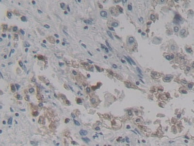 Surfactant Associated Protein D (SPD) Polyclonal Antibody - image 4