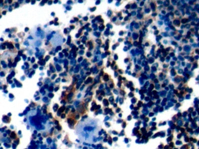 Protein Tyrosine Phosphatase Receptor Type C (CD45) Polyclonal Antibody - image 4