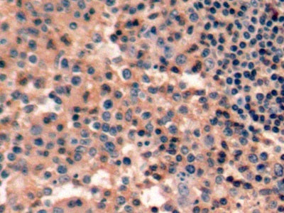 DAB staining on fromalin fixed paraffin-embedded Stomach tissue)