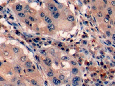 Protein Tyrosine Phosphatase Receptor Type C (CD45) Polyclonal Antibody - image 4