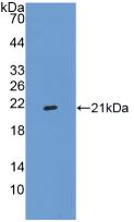 Integrin Alpha 2B (ITGa2B) Polyclonal Antibody - image 2