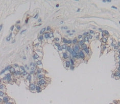 Integrin Alpha 2B (ITGa2B) Polyclonal Antibody - image 3