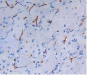 Albumin (ALB) Polyclonal Antibody - image 4