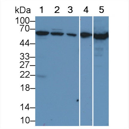 Albumin (ALB) Polyclonal Antibody - image 2