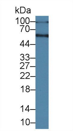 Albumin (ALB) Polyclonal Antibody - image 2