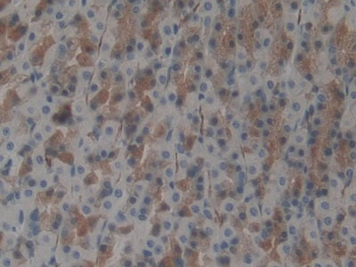 DAB staining on fromalin fixed paraffin- embedded lung tissue)