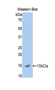 Amyloid Precursor Protein (APP) Polyclonal Antibody - image 2