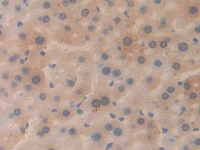 DAB staining on IHC-P; Samples: Mouse Liver Tissue