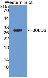 DAB staining on IHC-P; Samples: Mouse Testis Tissue; Primary Ab: 20μg/ml Rabbit Anti-Mouse APP Antibody Second Ab: 2µg/mL HRP-Linked Caprine Anti-Rabbit IgG Polyclonal Antibody