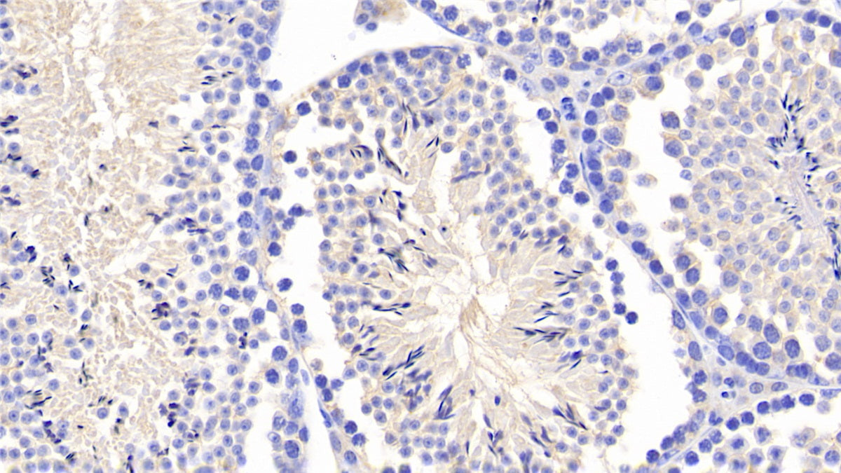 DAB staining on fromalin fixed paraffin-embedded Kidney tissue)