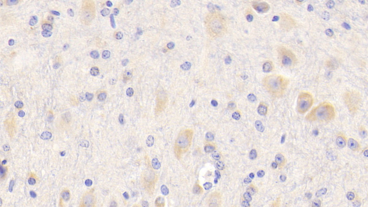 Amyloid Precursor Protein (APP) Polyclonal Antibody - image 5