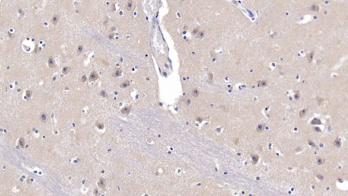 Amyloid Precursor Protein (APP) Polyclonal Antibody - image 3