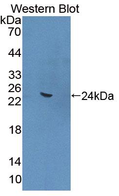 Angiopoietin Like Protein 4 (ANGPTL4) Polyclonal Antibody - image 2