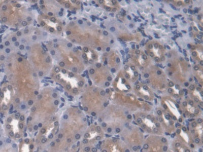 DAB staining on fromalin fixed paraffin- embedded Kidney tissue)