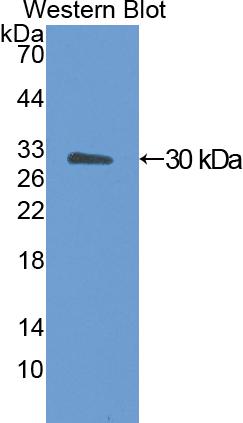 DAB staining on IHC-P; Samples: Rat Cardiac Muscle Tissue; Primary Ab: 10μg/ml Rabbit Anti-Rat ANGPTL4 Antibody Second Ab: 2µg/mL HRP-Linked Caprine Anti-Rabbit IgG Polyclonal Antibody