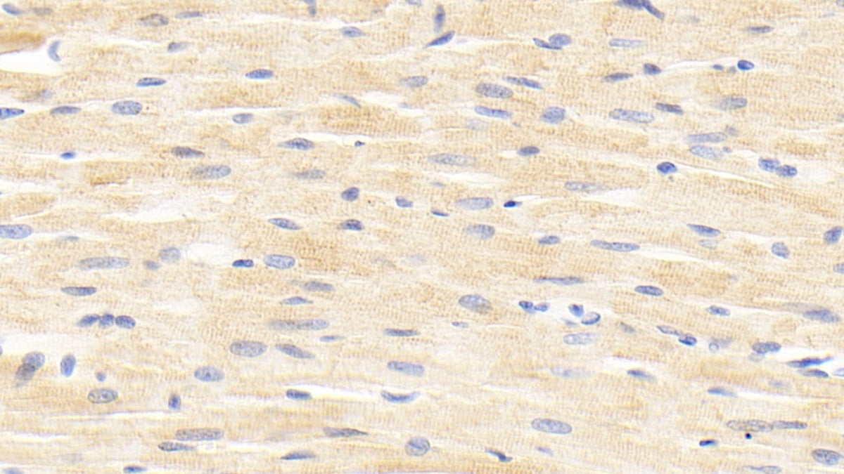 DAB staining on fromalin fixed paraffin-embedded kidney tissue)