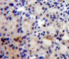 Angiopoietin Like Protein 4 (ANGPTL4) Polyclonal Antibody - image 5