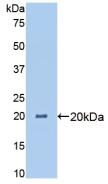 Angiopoietin Like Protein 4 (ANGPTL4) Polyclonal Antibody - image 2