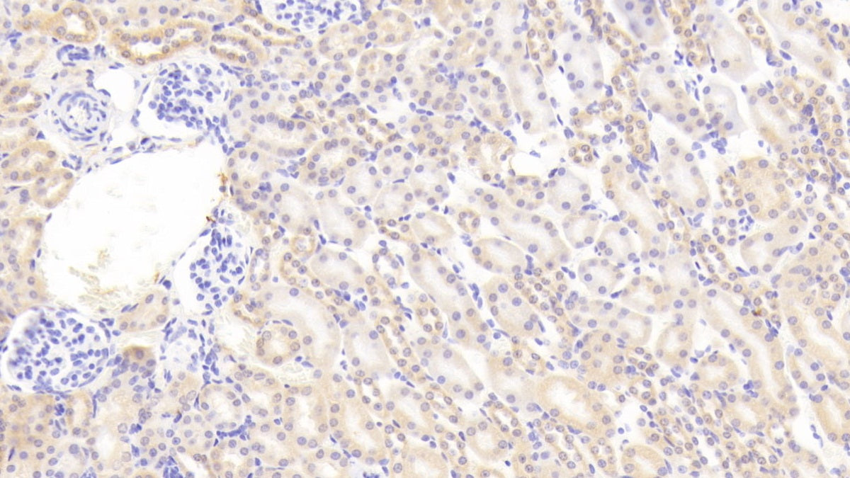 DABstainingonIHC-P.Samples:MouseTissue)